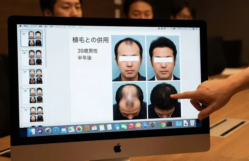 Apresenta&ccedil;&atilde;o de casos cl&iacute;nicos em reuni&atilde;o de pesquisa no Jap&atilde;o